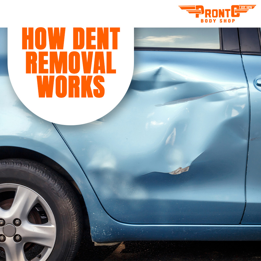 How Dent Removal Works